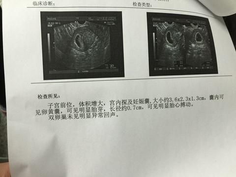 journal_insert_pic_411390718