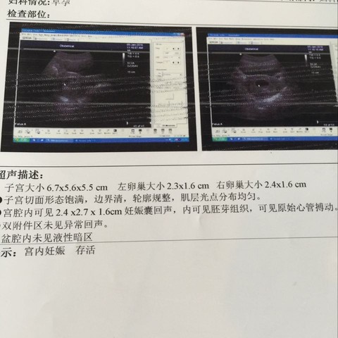journal_insert_pic_415809453