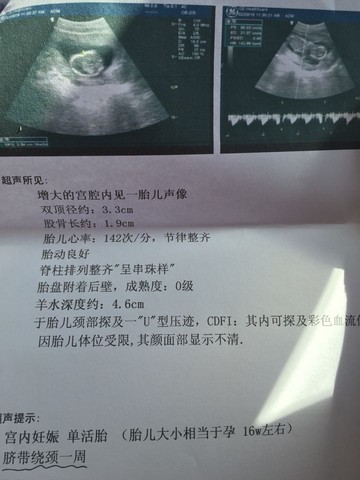 journal_insert_pic_415615142