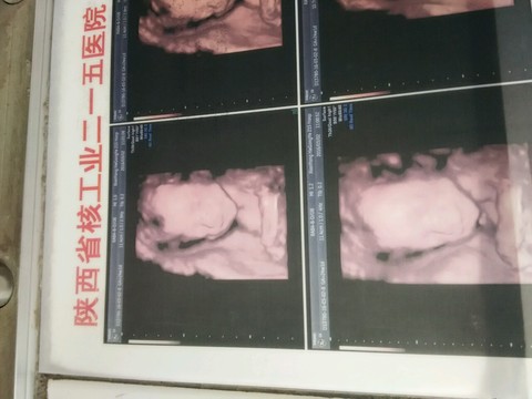 journal_insert_pic_417167511