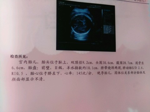 journal_insert_pic_418011678