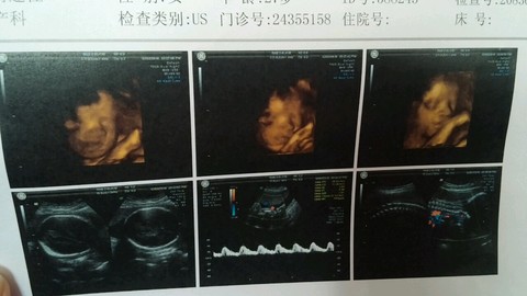 journal_insert_pic_418018723