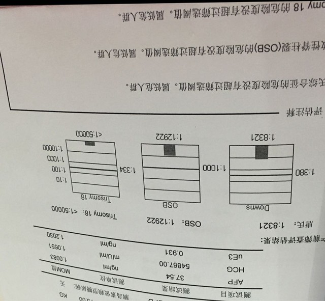 唐氏单子怎么看男女