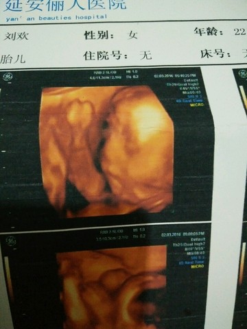 journal_insert_pic_421907505