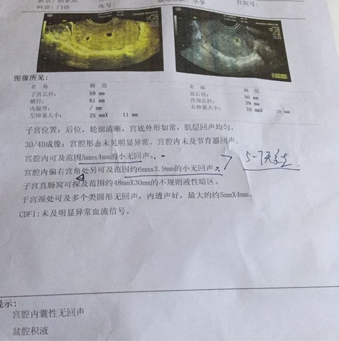 journal_insert_pic_423925215