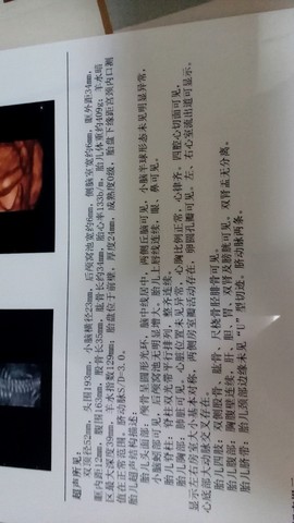 journal_insert_pic_424506865