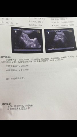 journal_insert_pic_427993901