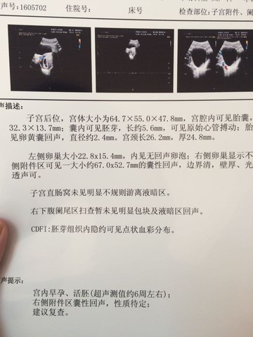 journal_insert_pic_428270735