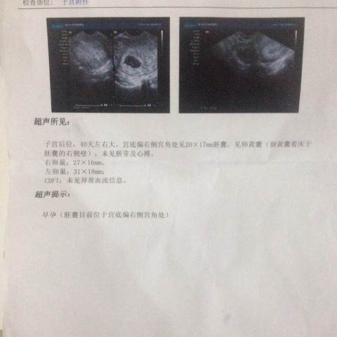 journal_insert_pic_429943988