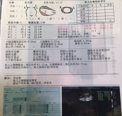 journal_insert_pic_429499937