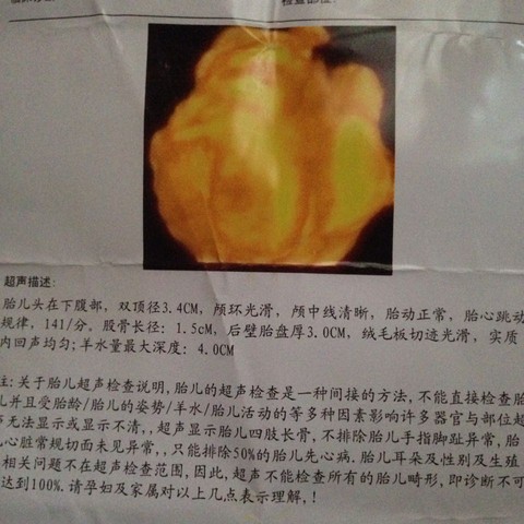journal_insert_pic_430045428