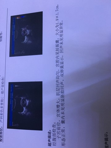 journal_insert_pic_430643844