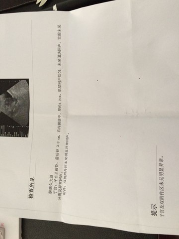 journal_insert_pic_430350595