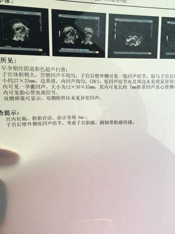 journal_insert_pic_431559047