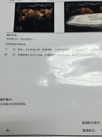 journal_insert_pic_432333988