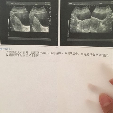 journal_insert_pic_434519051