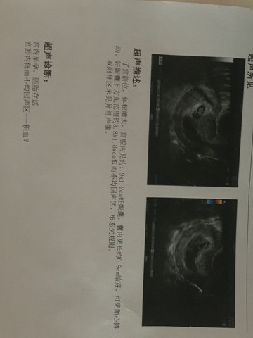 journal_insert_pic_434315202