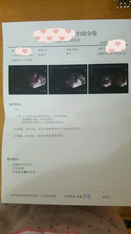 journal_insert_pic_435365453