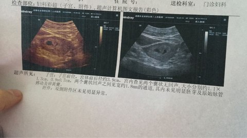 journal_insert_pic_435590064