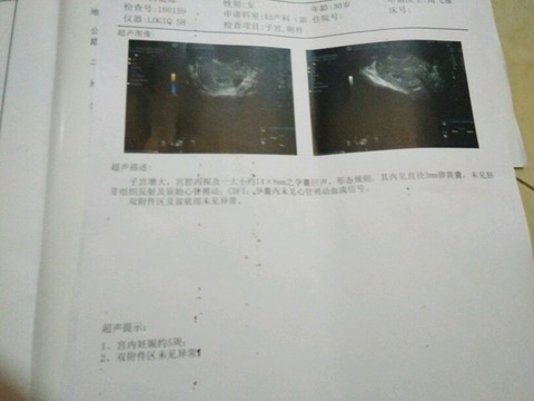 journal_insert_pic_435850661