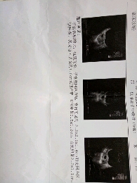 journal_insert_pic_437763881