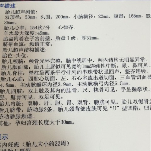 journal_insert_pic_437654143