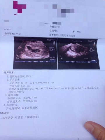 journal_insert_pic_438807728