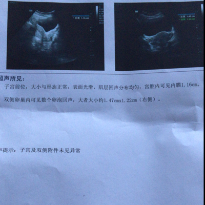 journal_insert_pic_439051342