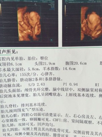 journal_insert_pic_439711513