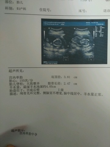 journal_insert_pic_440878158