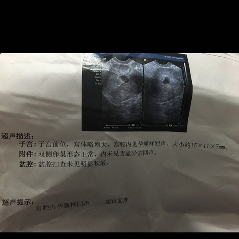 journal_insert_pic_441888712