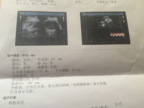 journal_insert_pic_443082143