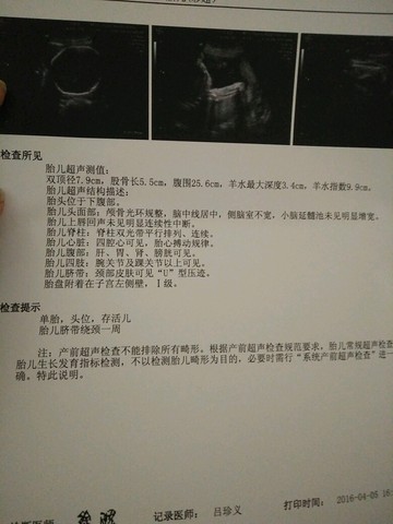 journal_insert_pic_444870607