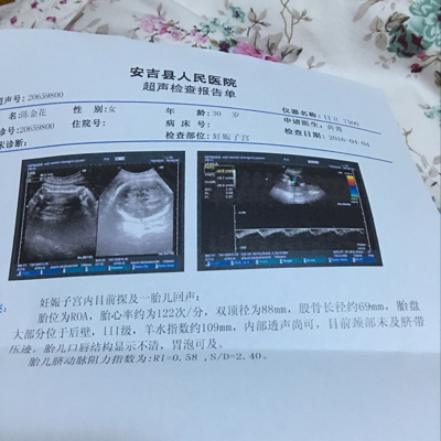 34周胎盘成熟三级,股骨长69双顶88妹妹,正常吗?胎盘成熟太早了吧?