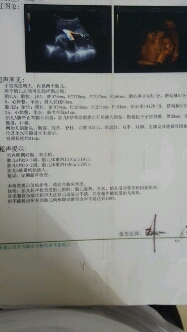 journal_insert_pic_445907514