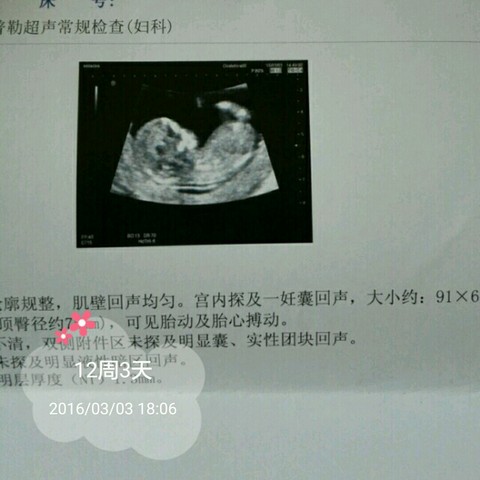 journal_insert_pic_446266861