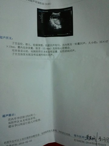 journal_insert_pic_446266904