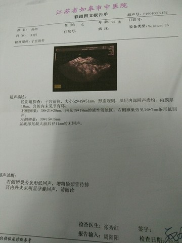 journal_insert_pic_447202671