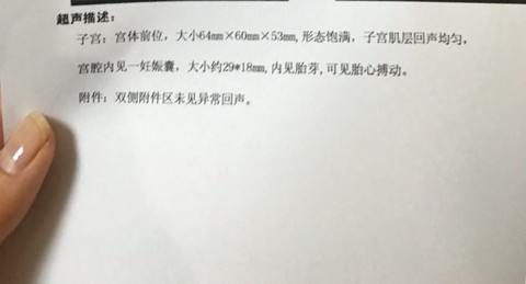 journal_insert_pic_448053014