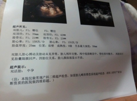 journal_insert_pic_448369216