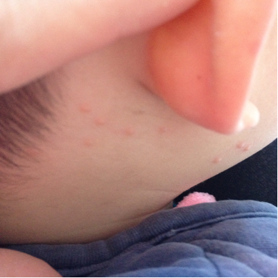残忍拒绝 推荐回答 湿疹吧,如果这季节不是花粉过敏就是湿疹,宝宝衣服