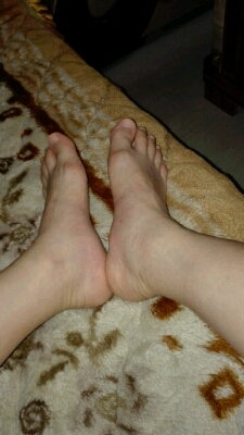 孕31周,脚水肿的厉害,有没有宝妈跟我一样的?