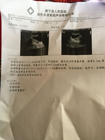 journal_insert_pic_449830362