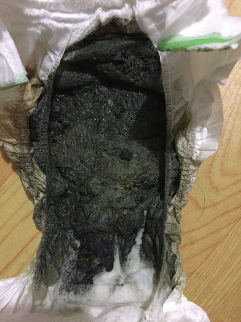 14个月宝宝大便这样 分析分析