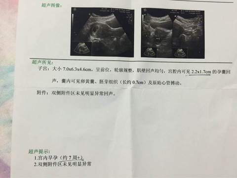 journal_insert_pic_453468817