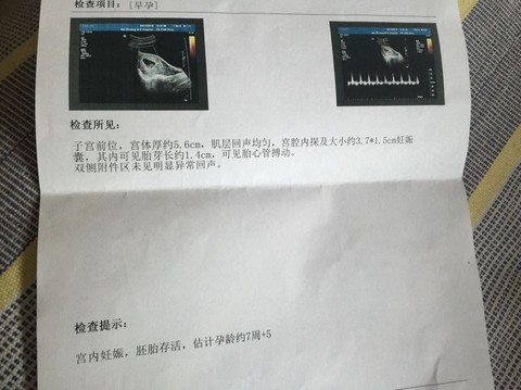 journal_insert_pic_454545888
