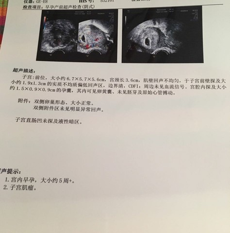 journal_insert_pic_454482255