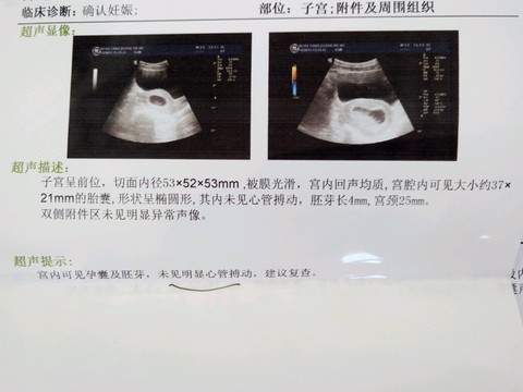 journal_insert_pic_454314829