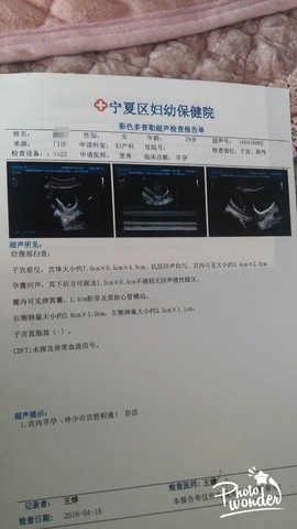 journal_insert_pic_454147061
