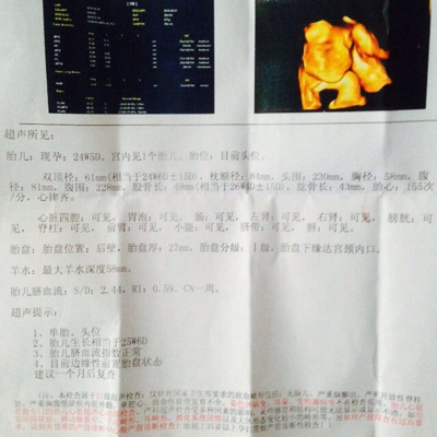 journal_insert_pic_454291515